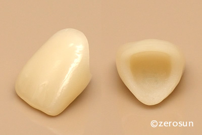 白い前歯